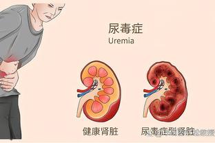 贝弗利的联盟新门面：哈利伯顿、爱德华兹、马克西、申京、杜伦